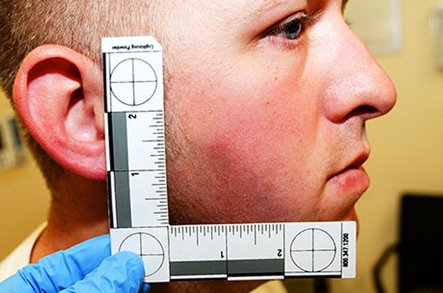 Darren Wilson sjekkes for skader.